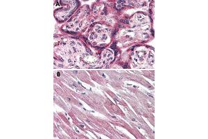 Immunohistochemical staining of formalin-fixed, paraffin-embedded human placenta (A) and human heart (B) tissue after heat-induced antigen retrieval. (EPHX2 Antikörper  (C-Term))