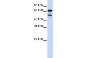 Image no. 1 for anti-Splicing Factor 4 (SF4) (AA 540-589) antibody (ABIN6740713) (Splicing Factor 4 Antikörper  (AA 540-589))