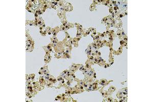 Immunohistochemistry of paraffin-embedded rat lung using CREBBP antibody (ABIN2736578) at dilution of 1:100 (40x lens). (CBP Antikörper)
