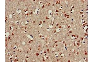 Immunohistochemistry of paraffin-embedded human brain tissue using ABIN7147214 at dilution of 1:100 (CDC42EP3 Antikörper  (AA 1-226))