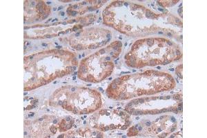 IHC-P analysis of Human Tissue, with DAB staining. (NG2 Antikörper  (AA 559-776))