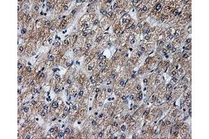 Immunohistochemical staining of paraffin-embedded liver tissue using anti-ANXA10mouse monoclonal antibody. (Annexin a10 Antikörper)