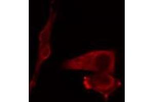 ABIN6269002 staining COLO205 cells by IF/ICC. (COL2A1 Antikörper  (N-Term))