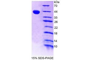 SDS-PAGE (SDS) image for Eosinophil Chemotactic Factor (ECF) (AA 24-97) protein (His tag,GST tag) (ABIN1980607)