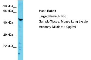 Host: Rabbit Target Name: Prkcq Sample Type: Mouse Lung lysates Antibody Dilution: 1. (PKC theta Antikörper  (C-Term))