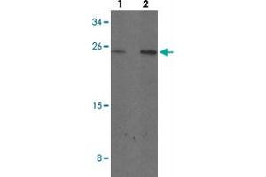 Western blot analysis of MYCT1 in rat lung tissue with MYCT1 polyclonal antibody  at (1) 1 and (2) 2 ug/mL. (Myc Target 1 Antikörper  (C-Term))