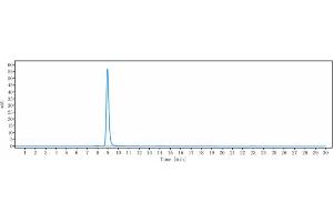 anti-IL6 (Ziltivekimab Biosimilar) antibody