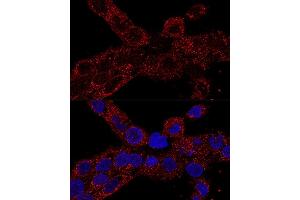 Confocal immunofluorescence analysis of A-431 cells using RPL21 antibody (ABIN7269996) at dilution of 1:100. (RPL21 Antikörper  (AA 1-160))