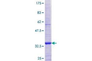 Image no. 1 for Zinc Finger Protein 525 (ZNF525) (AA 1-70) protein (GST tag) (ABIN1326261) (ZNF525 Protein (AA 1-70) (GST tag))