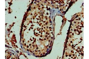 Immunohistochemistry of paraffin-embedded human testis tissue using ABIN7169424 at dilution of 1:100 (ASH2L Antikörper  (AA 1-534))