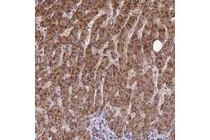 Immunohistochemical staining of human liver with FAM186B polyclonal antibody  shows strong cytoplasmic positivity in hepatocytes at 1:50-1:200 dilution. (FAM186B Antikörper)
