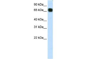 WB Suggested Anti-ZFP64 Antibody Titration:  1. (ZFP64 Antikörper  (C-Term))
