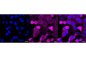Immunocytochemical staining of HT- cells with NCK1 antibody (ABIN7799562), 1:1,000).