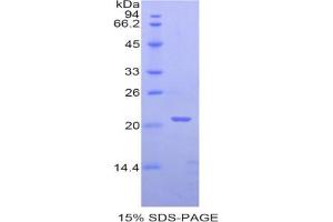 SDS-PAGE analysis of Human PPARD Protein.