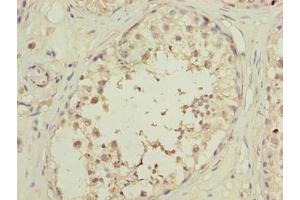 Immunohistochemistry of paraffin-embedded human testis tissue using ABIN7162226 at dilution of 1:100 (PLAC1L Antikörper  (AA 74-158))