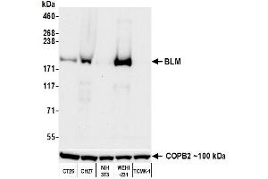 anti-Bloom Syndrome RecQ Like Helicase (BLM) (C-Term) antibody