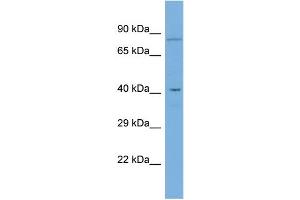 Host:  Rabbit  Target Name:  GDPD5  Sample Type:  COLO205 Whole Cell lysates  Antibody Dilution:  1. (GDPD5 Antikörper  (Middle Region))