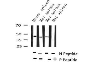 Western blot analysis of Phospho-CCR5 (Ser336) expression in various lysates (CCR5 Antikörper  (pSer336))