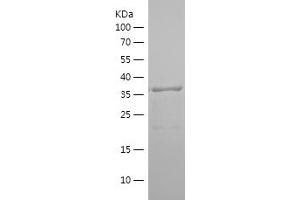 Western Blotting (WB) image for Peroxisome Proliferator-Activated Receptor gamma (PPARG) (AA 1-129) protein (His-IF2DI Tag) (ABIN7124375) (PPARG Protein (AA 1-129) (His-IF2DI Tag))