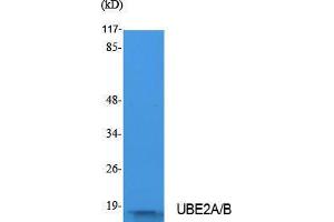 Western Blotting (WB) image for anti-UBE2A/B (C-Term) antibody (ABIN3180974) (UBE2A/B (C-Term) Antikörper)