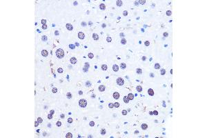 Immunohistochemistry (IHC) image for anti-Chromodomain Helicase DNA Binding Protein 4 (CHD4) (AA 1520-1690) antibody (ABIN6138512)