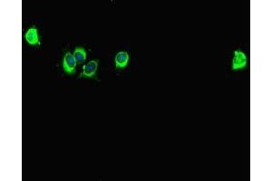 Immunofluorescent analysis of Hela cells using ABIN7146024 at dilution of 1:100 and Alexa Fluor 488-congugated AffiniPure Goat Anti-Rabbit IgG(H+L) (SPAG9 Antikörper  (N-Term))