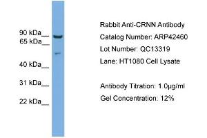 WB Suggested Anti-CRNN Antibody   Titration: 1.