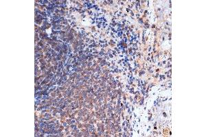 Immunohistochemistry of paraffin-embedded rat spleen using FNTB Rabbit mAb (ABIN1680761, ABIN3016316, ABIN3016317 and ABIN7101479) at dilution of 1:100 (40x lens). (FNTB Antikörper)
