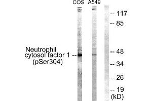 Western Blotting (WB) image for anti-Neutrophil Cytosol Factor 1 (NCF1) (pSer304) antibody (ABIN1847419) (NCF1 Antikörper  (pSer304))