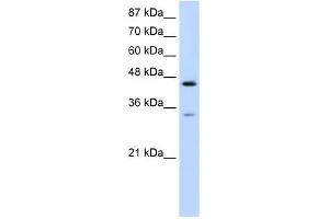 WB Suggested Anti-SF3B4 Antibody Titration:  0. (SF3B4 Antikörper  (N-Term))