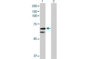 Western Blot analysis of SLC27A1 expression in transfected 293T cell line by SLC27A1 MaxPab polyclonal antibody. (SLC27A1 Antikörper  (AA 1-646))