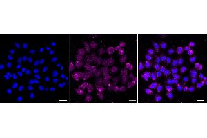 Immunocytochemical staining of HepG2 cells with CD46 antibody (ABIN7797974), 1:1,000). (Rekombinanter CD46 Antikörper)