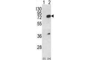 Western Blotting (WB) image for anti-Heterogeneous Nuclear Ribonucleoprotein L (HNRNPL) antibody (ABIN3001739) (HNRNPL Antikörper)