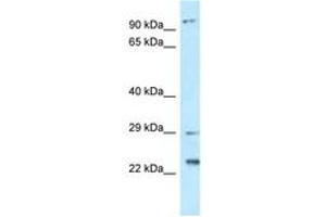 Image no. 1 for anti-Chromosome 17 Open Reading Frame 70 (C17ORF70) (AA 92-141) antibody (ABIN6747793) (C17orf70 Antikörper  (AA 92-141))