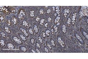 IHC analysis of MIEF1 using anti-MIEF1 antibody (ABIN7600396). (SMCR7L Antikörper  (AA 189-463))