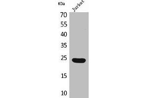 Western Blot analysis of Jurkat cells using IFN-ε Polyclonal Antibody (IFNE Antikörper  (C-Term))