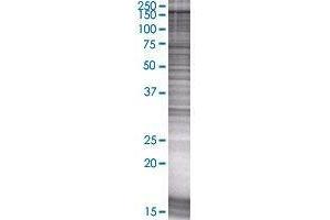 Western Blotting (WB) image for NALP1 293T Cell Transient Overexpression Lysate(Denatured) (ABIN1335438)