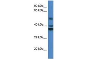 Image no. 1 for anti-Reticulon 4 Interacting Protein 1 (RTN4IP1) (AA 188-237) antibody (ABIN6746876) (RTN4IP1 Antikörper  (AA 188-237))