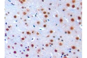 IHC-P analysis of Mouse Cerebrum Tissue, with DAB staining. (IRF1 Antikörper  (AA 44-319))