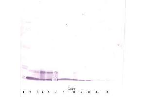 Image no. 4 for anti-Chemokine (C-X-C Motif) Ligand 10 (CXCL10) antibody (ABIN465012) (CXCL10 Antikörper)