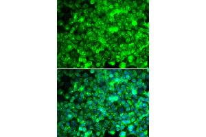 Immunofluorescence analysis of U20S cell using ADIPOR1 antibody. (Adiponectin Receptor 1 Antikörper)