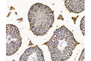 ABIN7096169 and ABIN7100231 at 1/100 staining mouse testis tissue by IHC-P. (RASAL1 Antikörper)