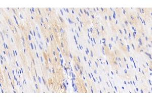 Detection of TNNT2 in Porcine Cardiac Muscle Tissue using Polyclonal Antibody to Troponin T Type 2, Cardiac (TNNT2) (Cardiac Troponin T2 Antikörper  (AA 56-271))
