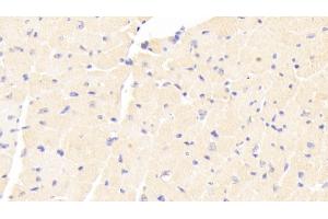 Detection of ADCY7 in Mouse Cardiac Muscle Tissue using Polyclonal Antibody to Adenylate Cyclase 7 (ADCY7)