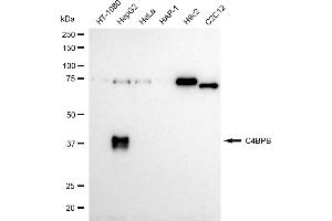 Western blotting analysis using C4BPB antibody (ABIN7798141). (Rekombinanter C4BPB Antikörper)