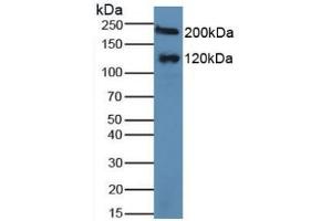 Detection of MGAM in Human Serum using Polyclonal Antibody to Maltase-glucoamylase (MGAM) (Maltase-Glucoamylase (MGAM) (AA 213-392) Antikörper)