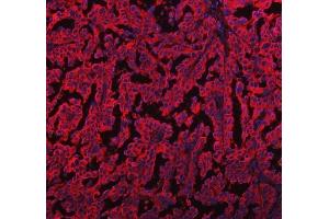 IF analysis of EML4 using anti-EML4 antibody (ABIN6719384). (EML4 Antikörper  (AA 207-423))