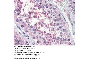 Immunohistochemistry with Human Testis lysate tissue at an antibody concentration of 5. (TRIM8 Antikörper  (N-Term))