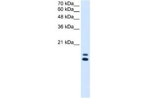 UXT antibody used at 2. (UXT Antikörper  (N-Term))