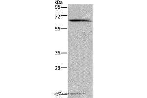 Western blot analysis of Human brain malignant glioma tissue, using NCF2 Polyclonal Antibody at dilution of 1:200 (NCF2 Antikörper)
